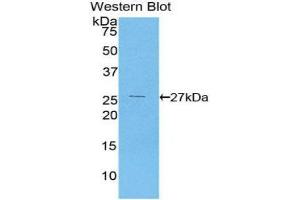 Western Blotting (WB) image for anti-Coagulation Factor XII (F12) (AA 400-615) antibody (ABIN3208108) (F12 Antikörper  (AA 400-615))