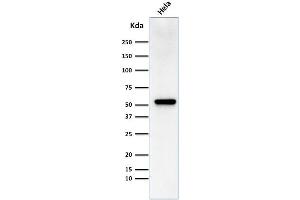 Western Blot Analysis of HeLa cell lysate using Fascin-1 Mouse Monoclonal Antibody (FSCN1/418) (Fascin Antikörper)