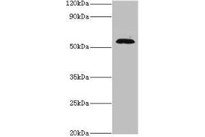 Western blot All lanes: TSEN2 antibody at 5 μg/mL + 293T whole cell lysate Secondary Goat polyclonal to rabbit IgG at 1/10000 dilution Predicted band size: 54, 52, 50, 48, 46 kDa Observed band size: 54 kDa (TSEN2 Antikörper  (AA 1-220))