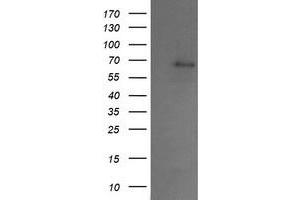 Image no. 1 for anti-SUMO1/sentrin/SMT3 Specific Peptidase 2 (SENP2) antibody (ABIN1500865) (SENP2 Antikörper)