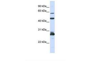 Image no. 1 for anti-Pescadillo Ribosomal Biogenesis Factor 1 (PES1) (C-Term) antibody (ABIN6739037) (PES1 Antikörper  (C-Term))