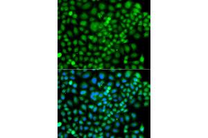 Immunofluorescence analysis of A549 cell using SUMO4 antibody. (SUMO4 Antikörper)