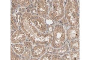 ABIN6266596 at 1/100 staining human kidney tissue sections by IHC-P. (MMP3 Antikörper  (C-Term))