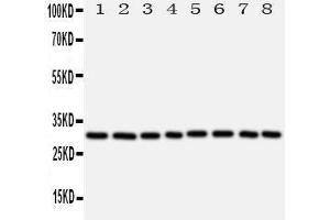 Western Blotting (WB) image for anti-Voltage-Dependent Anion Channel 1 (VDAC1) (AA 163-178), (Middle Region) antibody (ABIN3044167)