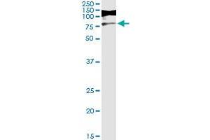 Immunoprecipitation of RIOK3 transfected lysate using anti-RIOK3 monoclonal antibody and Protein A Magnetic Bead , and immunoblotted with RIOK3 MaxPab rabbit polyclonal antibody. (RIOK3 Antikörper  (AA 1-516))