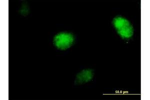 Immunofluorescence of purified MaxPab antibody to POLH on HeLa cell. (POLH Antikörper  (AA 1-713))