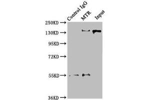 MTR Antikörper  (AA 923-1265)