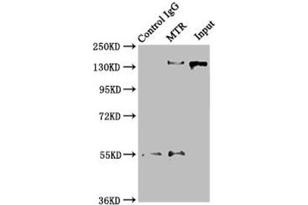 MTR Antikörper  (AA 923-1265)