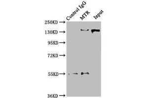Immunoprecipitating MTR in Hela whole cell lysate Lane 1: Rabbit control IgG instead of ABIN7159585 in Hela whole cell lysate. (MTR Antikörper  (AA 923-1265))