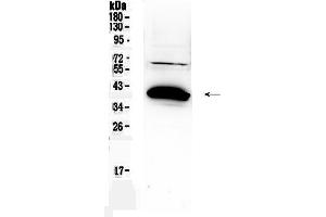 Western blot analysis of Bag1 using anti-Bag1 antibody . (BAG1 Antikörper  (C-Term))