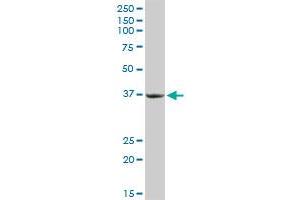 Western Blotting (WB) image for anti-Protein Kinase, Interferon-Inducible Double Stranded RNA Dependent Activator (PRKRA) (AA 1-313) antibody (ABIN522050)