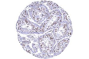 anti-Tripartite Motif Containing 28 (TRIM28) (Center) antibody