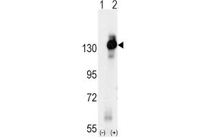 Western Blotting (WB) image for anti-Colony Stimulating Factor 1 Receptor (CSF1R) antibody (ABIN3003322)