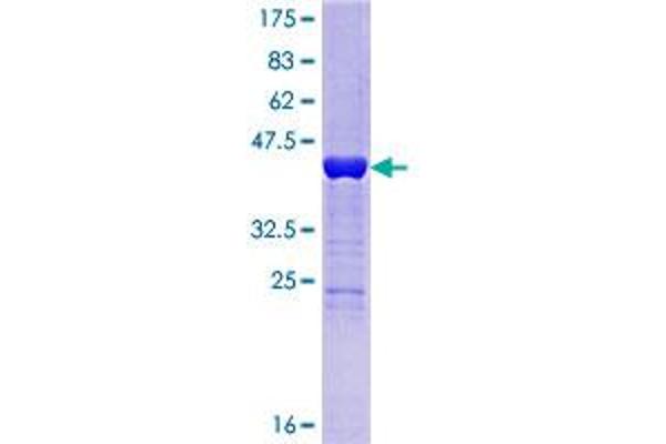 HDDC3 Protein (AA 1-140) (GST tag)