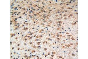 Used in DAB staining on fromalin fixed paraffin- embedded brain tissue (IGF2R Antikörper  (AA 1148-1365))