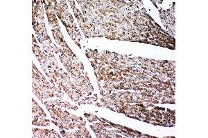 Anti-Gelsolin antibody, IHC(P) IHC(P): Rat Cardiac Muscle Tissue (Gelsolin Antikörper  (C-Term))