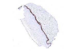 Ectocervix In non keratinizing squamous epithelium the basal cells are CK19 positive while the remaining layers are usually negative