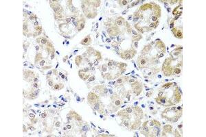 Immunohistochemistry of paraffin-embedded Human stomach using ALKBH4 Polyclonal Antibody at dilution of 1:100 (40x lens). (ALKBH4 Antikörper)