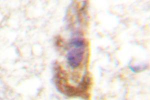 Image no. 1 for anti-Protein Kinase C, zeta (PRKCZ) antibody (ABIN272064) (PKC zeta Antikörper)