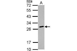 WB Image Sample (30 ug of whole cell lysate) A: K562 12% SDS PAGE antibody diluted at 1:1000 (HLA-DQB2 Antikörper)