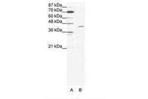 Image no. 1 for anti-T-Cell Acute Lymphocytic Leukemia 1 (TAL1) (C-Term) antibody (ABIN202265) (TAL1 Antikörper  (C-Term))