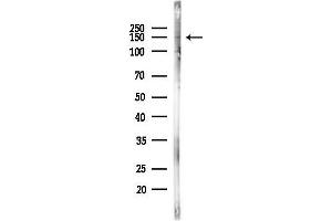 Western blot analysis of lysates from PC12 cells, using SLC12 Antibody at 1/1000 dilution.