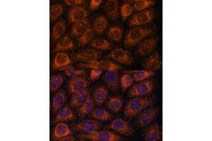 Immunofluorescence analysis of HeLa cells using CCT6B antibody (ABIN7270709) at dilution of 1:100. (CCT6B Antikörper  (AA 120-340))