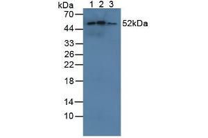 Figure. (CYP21A2 Antikörper  (AA 37-264))