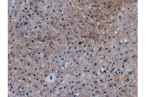 Detection of CCL27 in Human Liver Tissue using Monoclonal Antibody to Chemokine (C-X-C Motif) Ligand 27 (CCL27) (Chemokine (C-X-C Motif) Ligand 27 (AA 25-112) Antikörper)