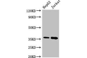 Western Blot Positive WB detected in: HepG2 whole cell lysate, Jurkat whole cell lysate All lanes: TYMS antibody at 2. (TYMS Antikörper  (AA 2-54))