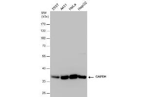 WB Image GAPDH antibody detects GAPDH protein by western blot analysis.