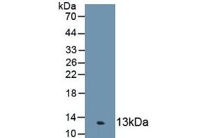 Detection of Recombinant C4c, Human using Polyclonal Antibody to Complement Component 4c (C4c)