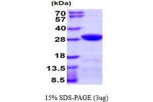 SDS-PAGE (SDS) image for Casein beta (CSN2) (AA 16-226) protein (His tag) (ABIN668028)