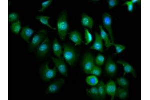 Immunofluorescence (IF) image for anti-Zinc Finger, MIZ-Type Containing 1 (ZMIZ1) (AA 405-559) antibody (ABIN7176088)