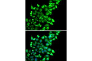Immunofluorescence analysis of U20S cell using MEST antibody. (MEST Antikörper)