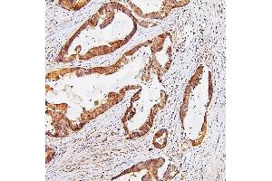 IHC analysis of TDRD3 using anti-TDRD3 antibody (ABIN6719636). (TDRD3 Antikörper)