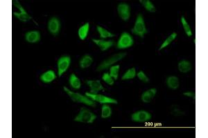 Immunofluorescence of purified MaxPab antibody to TRIM25 on HeLa cell. (TRIM25 Antikörper  (AA 1-630))