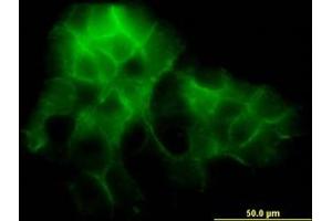 Image no. 2 for anti-Protocadherin 1 (PCDH1) (AA 62-170) antibody (ABIN598857) (Protocadherin 1 Antikörper  (AA 62-170))