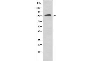Western blot analysis of extracts from Jurkat cells, using CNKR2 antibody. (CNKSR2 Antikörper  (Internal Region))