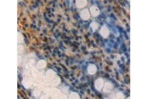 Used in DAB staining on fromalin fixed paraffin-embedded rectum tissue (FAM3D Antikörper  (AA 26-224))