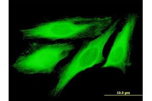 Immunofluorescence of purified MaxPab antibody to TUBB4Q on HeLa cell. (TUBB7P Antikörper  (AA 1-434))