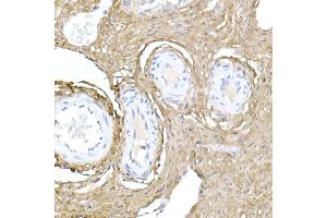Immunohistochemistry of paraffin-embedded rat ovary using Collagen I/COL1 Rabbit pAb (352) at dilution of 1:150 (40x lens). (COL1A1 Antikörper  (AA 100-200))