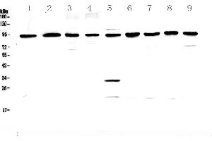 Western blot analysis of GNS using anti-GNS antibody . (GNS Antikörper  (AA 238-355))