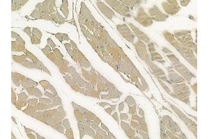 ABIN6258905 and ABIN6273508 at 1/100 staining human tongue carcinoma by IHC-P. (GZMK Antikörper  (Internal Region))