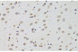 Immunohistochemistry of paraffin-embedded Mouse brain using TMPO Polyclonal Antibody at dilution of 1:100 (40x lens). (Thymopoietin Antikörper)