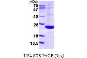 Dual Specificity Phosphatase 21 (DUSP21) (AA 1-190) protein (His tag)