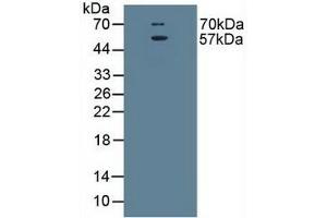 Detection of EAAT3 in Rat Brain Tissue using Polyclonal Antibody to Excitatory Amino Acid Transporter 3 (EAAT3) (SLC1A1 Antikörper  (AA 115-209))