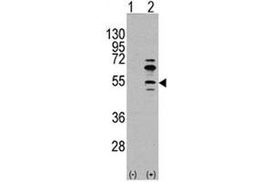 Western blot analysis of MEF2C antibody and 293 cell lysate (2 ug/lane) either nontransfected (Lane 1) or transiently transfected with the MEF2C gene (2). (MEF2C Antikörper  (AA 37-66))