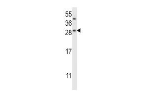 CHMP2B Antikörper  (N-Term)