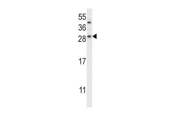 CHMP2B Antikörper  (N-Term)